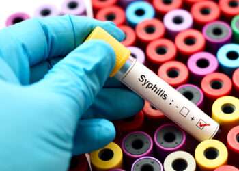 Blood sample positive with syphilis