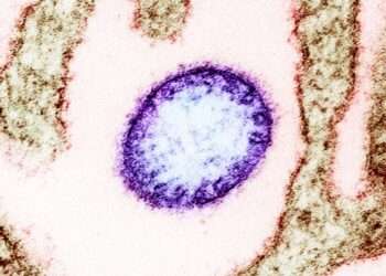Célula infectada pelo vírus Nipah. Foto: Creative Commons