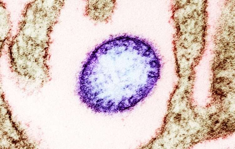 Célula infectada pelo vírus Nipah. Foto: Creative Commons