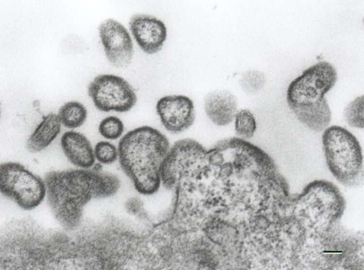 Foto: Reprodução/大阪医科薬科大学医学部微生物学