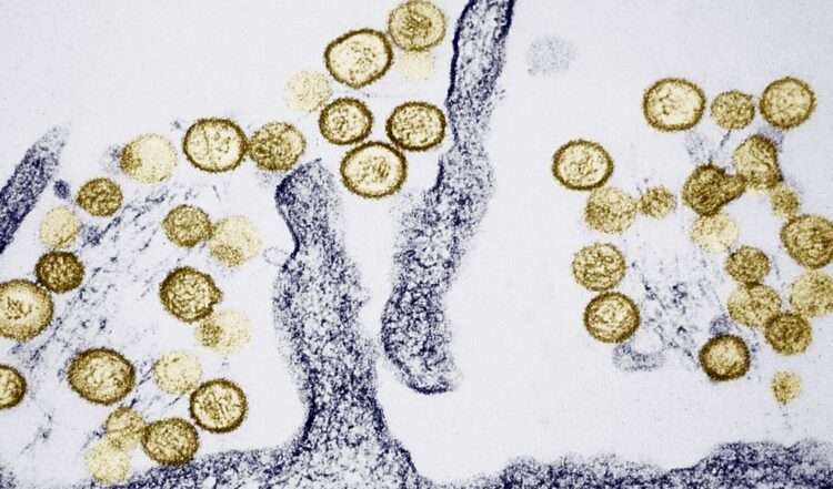 Hantavírus visto de microscópio. Foto: Reprodução/FNN